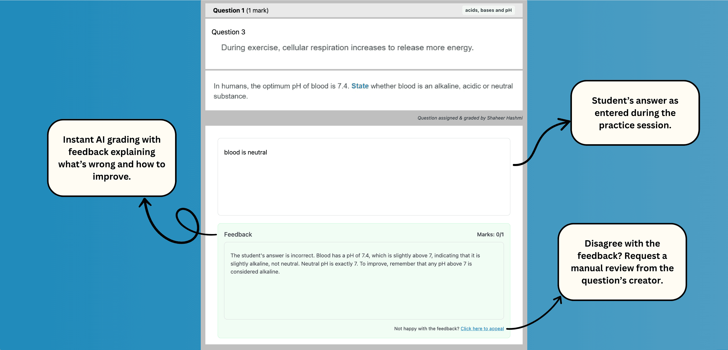 AI feedback interface